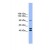 Western Blot: ENPP2 Antibody [NBP1-59852] - This Anti-ENPP2 antibody was used in Western Blot of COLO205       tissue lysate at a concentration of 1ug/ml.